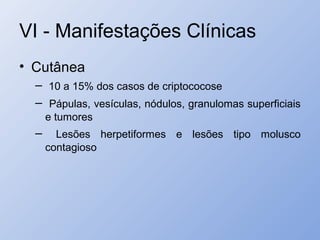 VI - Manifestações Clínicas
• Cutânea
– 10 a 15% dos casos de criptococose
– Pápulas, vesículas, nódulos, granulomas superficiais
e tumores
– Lesões herpetiformes e lesões tipo molusco
contagioso
 