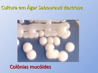 Cultura em Ágar Sabouraud dextroseCultura em Ágar Sabouraud dextrose
Colônias mucóidesColônias mucóides
 