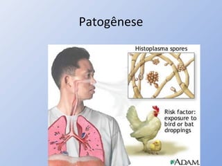 Patogênese
 