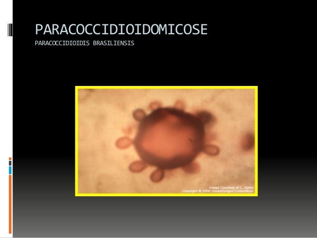 Mastocitoza sistemică - simptome și tratament