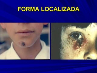 FORMA LOCALIZADA 