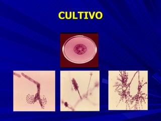 CULTIVO 