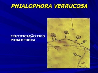 PHIALOPHORA VERRUCOSA FRUTIFICAÇÃO TIPO  PHIALOPHORA 
