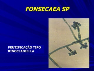 FONSECAEA SP FRUTIFICAÇÃO TIPO RINOCLADIELLA 