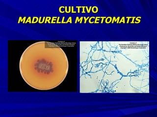 CULTIVO MADURELLA MYCETOMATIS 