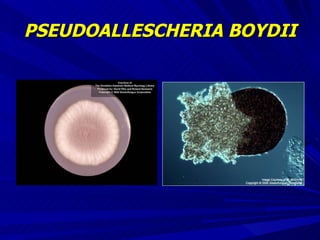 PSEUDOALLESCHERIA BOYDII 