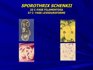 SPOROTHRIX SCHENKII 25 C-FASE FILAMENTOSA 37 C- FASE LEVEDURIFORME 