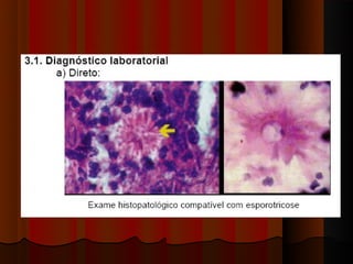 Micoses superficiais