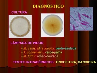 DIAGNÓSTICO
CULTURA




LÂMPADA DE WOOD
     - M. canis, M. audouini: verde-azulada
     - T. schoenleini: verde-palha
     - M. furfur: róseo-dourada
 TESTES INTRADÉRMICOS: TRICOFITINA, CANDIDINA
 