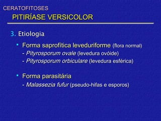 CERATOFITOSES
  PITIRÍASE VERSICOLOR

  3. Etiologia
       Forma saprofítica leveduriforme (flora normal)
        - Pityrosporum ovale (levedura ovóide)
        - Pityrosporum orbiculare (levedura esférica)

       Forma parasitária
        - Malassezia fufur (pseudo-hifas e esporos)
 