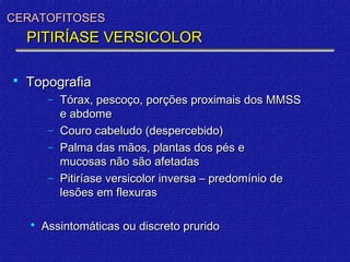 CERATOFITOSES
    PITIRÍASE VERSICOLOR

   Topografia
         −   Tórax, pescoço, porções proximais dos MMSS
             e abdome
         −   Couro cabeludo (despercebido)
         −   Palma das mãos, plantas dos pés e
             mucosas não são afetadas
         −   Pitiríase versicolor inversa – predomínio de
             lesões em flexuras

       Assintomáticas ou discreto prurido
 