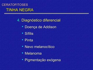 CERATOFITOSES
  TINHA NEGRA

       4. Diagnóstico diferencial
            Doença de Addison
            Sífilis
            Pinta
            Nevo melanocítico
            Melanoma
            Pigmentação exógena
 