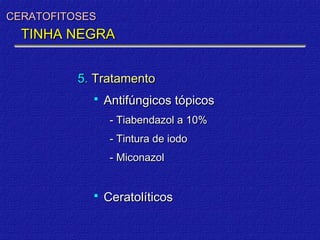 CERATOFITOSES
  TINHA NEGRA


          5. Tratamento
               Antifúngicos tópicos
                 - Tiabendazol a 10%
                 - Tintura de iodo
                 - Miconazol


               Ceratolíticos
 