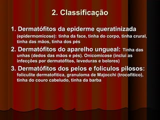2. Classificação

1. Dermatófitos da epiderme queratinizada
  (epidermomicose): tinha da face, tinha do corpo, tinha crural,
  tinha das mãos, tinha dos pés
2. Dermatófitos do aparelho ungueal: Tinha das
  unhas (dedos das mãos e pés). Onicomicose (inclui as
  infecções por dermatófitos, leveduras e bolores)
3. Dermatófitos dos pelos e folículos pilosos:
  foliculite dermatofítica, granuloma de Majocchi (trocofítico),
  tinha do couro cabeludo, tinha da barba
 