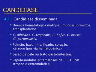 CANDIDÍASE
4.11 Candidíase disseminada
    Doença hematológica maligna, imunossuprimidos,
     transplantados
    C. albicans, C. tropicalis, C. Kefyr, C. krusei,
     C. parapsilosis.
    Pulmão, baço, rins, fígado, coração,
     cérebro (por via hematogênica)
    Lesão de pele ou trato gastrointestinal
    Papulo-nódulos eritematosos de 0,5-1,0cm
     (tronco e extremidades)
 