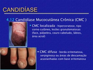 CANDIDÍASE
 4.12 Candidíase Mucocutânea Crônica (CMC )
              CMC localizada - hiperceratose, tipo
              corno cutâneo, lesões granulomatosas
              (face, pálpebra, couro cabeludo, lábios,
              área acral)




                   CMC difusa - borda eritematosa,
                    serpiginosa ou áreas de descamação
                    acastanhadas com base eritematosa
 