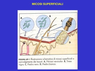 MICOSI SUPERFICIALI
 