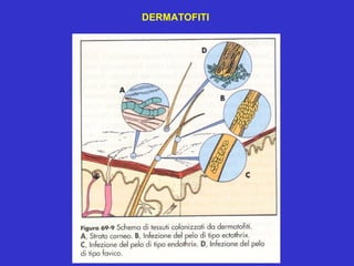 DERMATOFITI
 