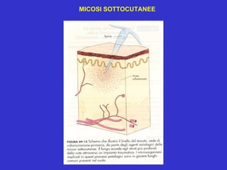MICOSI SOTTOCUTANEE
 