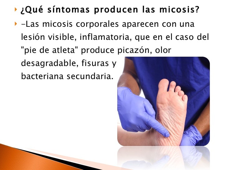 La crema para el tratamiento del hongo de las uñas al niño
