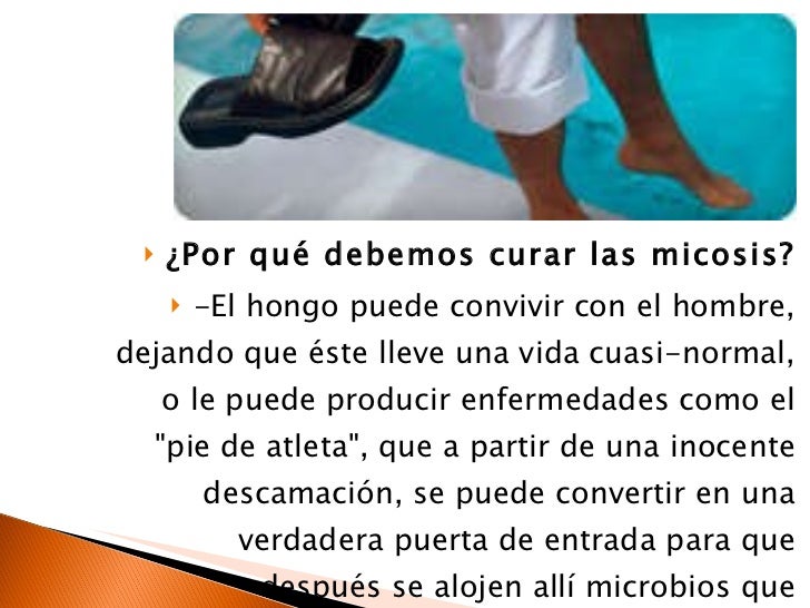 Los modos del tratamiento del hongo de uña en los pies