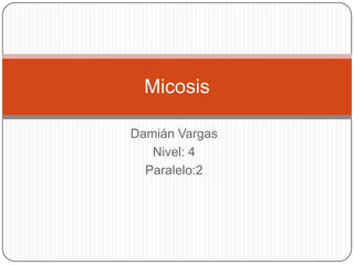 Micosis

Damián Vargas
   Nivel: 4
  Paralelo:2
 