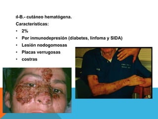 II-B.-   cutáneo hematógena.
Características:
• 2%
• Por inmunodepresión (diabetes, linfoma y SIDA)
• Lesión nodogomosas
• Placas verrugosas
• costras
 