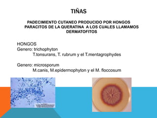 TIÑAS
    PADECIMIENTO CUTANEO PRODUCIDO POR HONGOS
   PARACITOS DE LA QUERATINA A LOS CUALES LLAMAMOS
                     DERMATOFITOS


HONGOS
Genero: trichophyton
       T.tonsurans, T. rubrum y el T.mentagrophydes

Genero: microsporum
       M.canis, M.epidermophyton y el M. floccosum
 