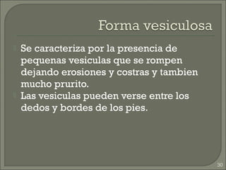    Se caracteriza por la presencia de
    pequenas vesiculas que se rompen
    dejando erosiones y costras y tambien
    mucho prurito.
   Las vesiculas pueden verse entre los
    dedos y bordes de los pies.




                                            30
 