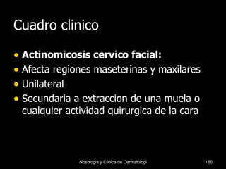 Cuadro clinico Actinomicosis cervico facial: Afecta regiones maseterinas y maxilares Unilateral Secundaria a extraccion de una muela o cualquier actividad quirurgica de la cara 