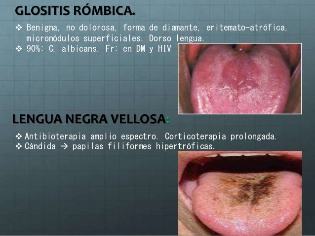(20170309)Micosis superficiales (PPT)