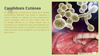 Candidosis Cutánea
Es una infección causada por el hongo de la cándida
(comúnmente Albicans), este hongo se reproduce y
causa la afección en regiones con poca oxigenación y
mucha humedad, como lo sería, axilas, ingle, etc.
La candida albicans es un hongo asexual, que se
encuentra en la cavidad oral, tracto gastrointestinal, etc.
forma parte del cuerpo y nos ayudan a la fermentación,
estos se pueden tornar patógenos si se reproducen en
gran manera.
 