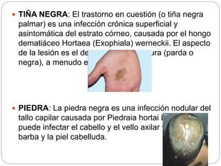 Micosis | PPTX