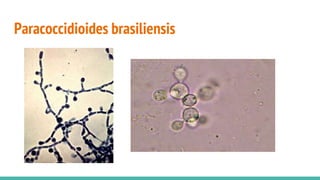 Paracoccidioides brasiliensis
 