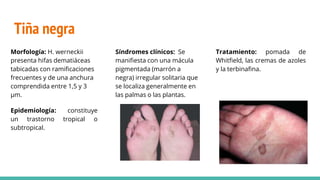 Tiña negra
Morfología: H. werneckii
presenta hifas dematiáceas
tabicadas con ramificaciones
frecuentes y de una anchura
comprendida entre 1,5 y 3
µm.
Epidemiología: constituye
un trastorno tropical o
subtropical.
Síndromes clínicos: Se
manifiesta con una mácula
pigmentada (marrón a
negra) irregular solitaria que
se localiza generalmente en
las palmas o las plantas.
Tratamiento: pomada de
Whitfield, las cremas de azoles
y la terbinafina.
 