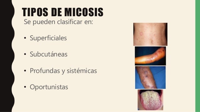 Micosis- Microbiología