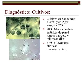 Diagnóstico: Cultivos: Cultivos en Sabouraud a 28°C y en Agar sangre a 37°C. 28°C:Macroconidias esféricas de pared rugosa y gruesa y microconidias. 37°C : Levaduras elípticas monogemantes. 
