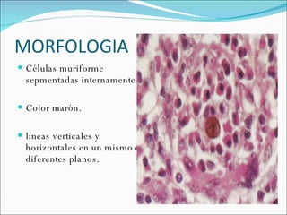 MORFOLOGIA  Células muriforme sepmentadas internamente.  Color marón. líneas verticales y horizontales en un mismo o diferentes planos.  