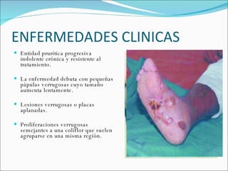 ENFERMEDADES CLINICAS Entidad prurítica progresiva indolente crónica y resistente al tratamiento. La enfermedad debuta con pequeñas pápulas verrugosas cuyo tamaño aumenta lentamente.  Lesiones verrugosas o placas aplanadas.  Proliferaciones verrugosas semejantes a una coliflor que suelen agruparse en una misma región.  