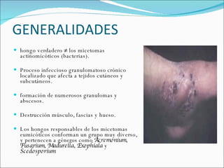 GENERALIDADES  hongo verdadero ≠ los micetomas actinomicóticos (bacterias).  Proceso infeccioso granulomatoso crónico localizado que afecta a tejidos cutáneos y subcutáneos.  formación de numerosos granulomas y abscesos.  Destrucción músculo, fascias y hueso.  Los hongos responsables de los micetomas eumicóticos conforman un grupo muy diverso, y pertenecen a géneros como  Acremonium, Fusarium, Madurella, Exophiala  y  Scedosporium  