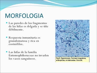 MORFOLOGIA  Las paredes de los fragmentos de las hifas es delgada y se tiñe débilmente.  Respuesta inmunitaria es granulomatosa y rica en eosinófilos.  Las hifas de la familia Entomophthoraceae no invaden los vasos sanguíneos. 