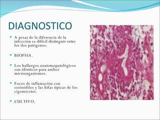 DIAGNOSTICO  A pesar de la diferencia de la infección es difícil distinguir entre los dos patógenos. BIOPSIA. Los hallazgos anatomopatológicos son idénticos para ambos microorganismos.  Focos de inflamación con eosinófilos y las hifas típicas de los cigomicetos.  CULTIVO.  