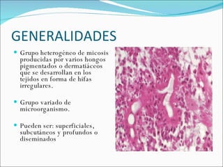 GENERALIDADES  Grupo heterogéneo de micosis producidas por varios hongos pigmentados o dermatiáceos que se desarrollan en los tejidos en forma de hifas irregulares. Grupo variado de microorganismo.  Pueden ser: superficiales, subcutáneos y profundos o diseminados 
