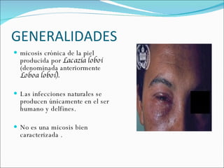 GENERALIDADES  micosis crónica de la piel producida por  Lacazia loboi  (denominada anteriormente  Loboa loboi).  Las infecciones naturales se producen únicamente en el ser humano y delfines.  No es una micosis bien caracterizada . 