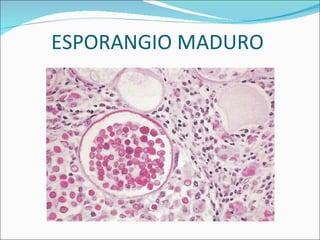 ESPORANGIO MADURO  