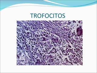 TROFOCITOS  