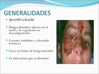 GENERALIDADES  Sporothri schenckü Hongo dimórfico ubicuo en el suelo y la vegetación en descomposición.  Lesiones nodulares y ulceradas (crónica)  Crece en forma de hongo micelial.  Es infrecuente que se disemine  