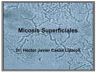 Micosis Superficiales Dr. Héctor Javier Casas Liparoli 