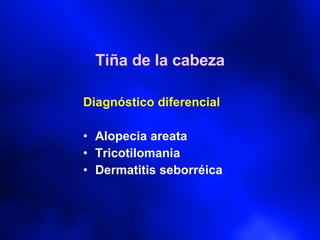 Tiña de la cabeza Diagnóstico diferencial Alopecia areata Tricotilomania Dermatitis seborréica 