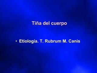 Tiña del cuerpo Etiología. T. Rubrum M. Canis 